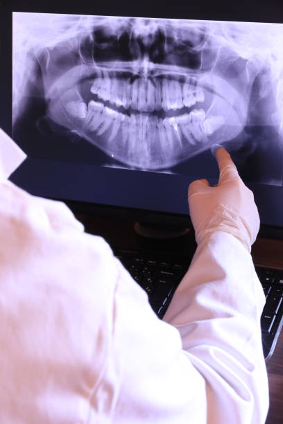 Best Knocked-Out Tooth (Avulsed Tooth) Treatment in Zephyrhills South, FL